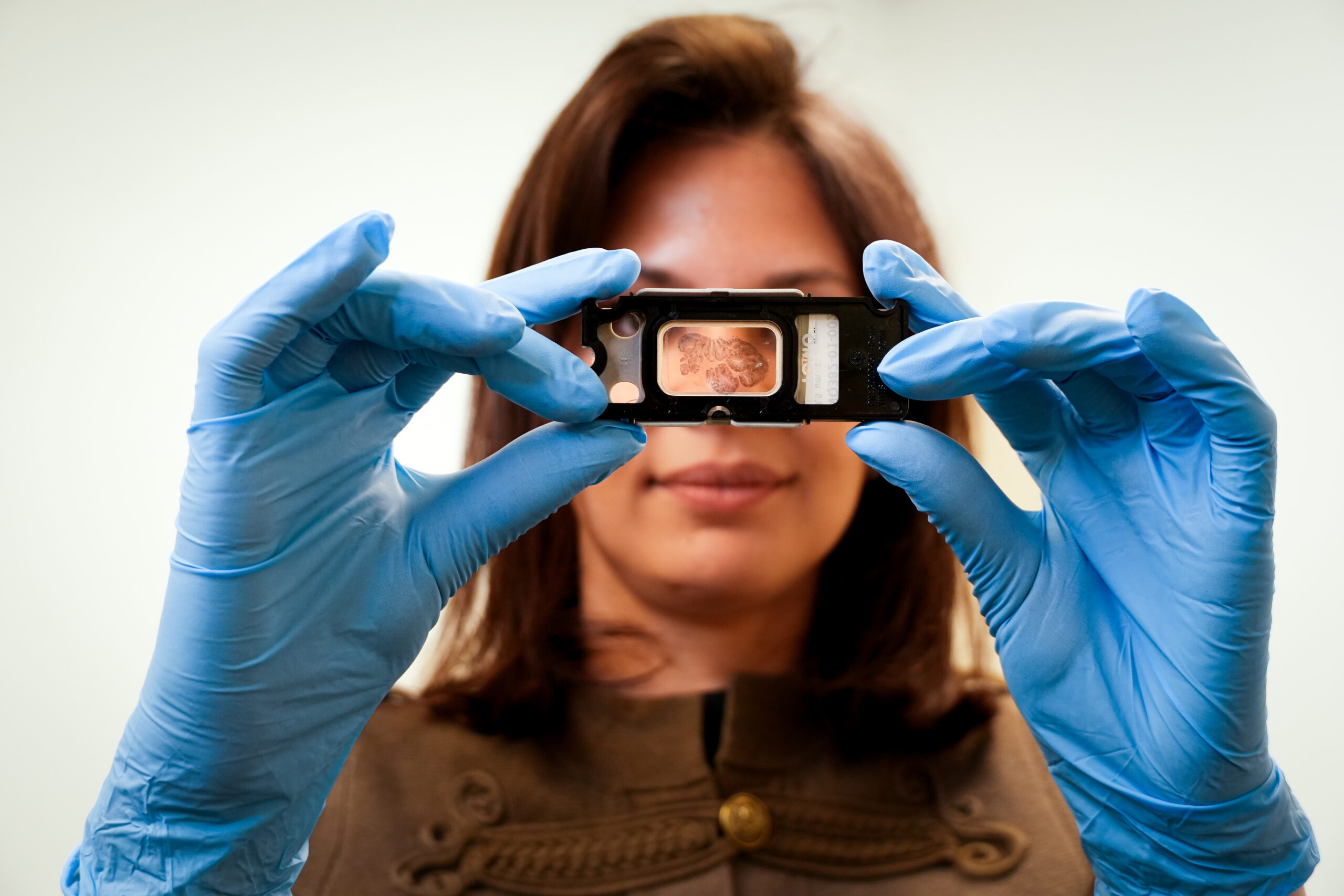 Image de l'évenement Explicyte et Cure51 s’associent pour placer les survivants exceptionnels du cancer au cœur de la recherche